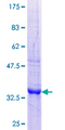 Chymotrypsin C Protein - 12.5% SDS-PAGE Stained with Coomassie Blue.