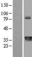 CIAPIN1 / Anamorsin Protein - Western validation with an anti-DDK antibody * L: Control HEK293 lysate R: Over-expression lysate