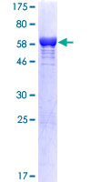 CIAPIN1 / Anamorsin Protein - 12.5% SDS-PAGE of human CIAPIN1 stained with Coomassie Blue
