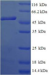 CIAPIN1 / Anamorsin Protein