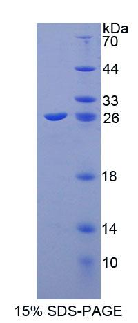 CIB1 / KIP Protein - Recombinant Calcium And Integrin Binding Protein 1 By SDS-PAGE