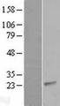 CIB2 / KIP2 Protein - Western validation with an anti-DDK antibody * L: Control HEK293 lysate R: Over-expression lysate