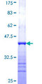 CIB2 / KIP2 Protein - 12.5% SDS-PAGE Stained with Coomassie Blue.