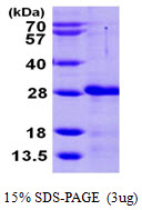 CIB2 / KIP2 Protein