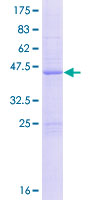 CIB4 Protein - 12.5% SDS-PAGE of human CIB4 stained with Coomassie Blue