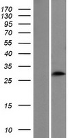 CIDEA / CIDE-A Protein - Western validation with an anti-DDK antibody * L: Control HEK293 lysate R: Over-expression lysate