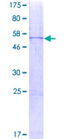 CIDEA / CIDE-A Protein - 12.5% SDS-PAGE of human CIDEA stained with Coomassie Blue