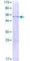 CIDEA / CIDE-A Protein - 12.5% SDS-PAGE of human CIDEA stained with Coomassie Blue
