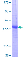 CIDEB Protein - 12.5% SDS-PAGE of human CIDEB stained with Coomassie Blue