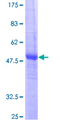 CIDEB Protein - 12.5% SDS-PAGE of human CIDEB stained with Coomassie Blue