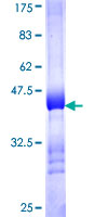 CIDEB Protein - 12.5% SDS-PAGE Stained with Coomassie Blue.