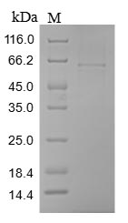 CILP Protein - (Tris-Glycine gel) Discontinuous SDS-PAGE (reduced) with 5% enrichment gel and 15% separation gel.