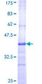 CILP Protein - 12.5% SDS-PAGE Stained with Coomassie Blue.