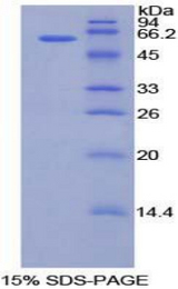 CILP Protein - Recombinant Cartilage Intermediate Layer Protein By SDS-PAGE