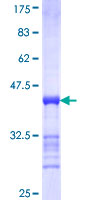 CINP Protein - 12.5% SDS-PAGE Stained with Coomassie Blue.