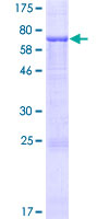 CIPC / KIAA1737 Protein - 12.5% SDS-PAGE of human KIAA1737 stained with Coomassie Blue