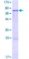 CIPC / KIAA1737 Protein - 12.5% SDS-PAGE of human KIAA1737 stained with Coomassie Blue
