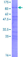 CIR1 Protein - 12.5% SDS-PAGE of human CIR stained with Coomassie Blue