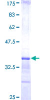 CIR1 Protein - 12.5% SDS-PAGE Stained with Coomassie Blue.