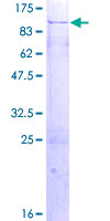 CIRH1A Protein - 12.5% SDS-PAGE of human CIRH1A stained with Coomassie Blue