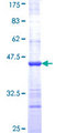 CIRH1A Protein - 12.5% SDS-PAGE Stained with Coomassie Blue.