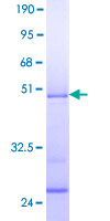 CIRP / CIRBP Protein - 12.5% SDS-PAGE of human CIRBP stained with Coomassie Blue