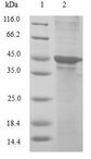 CIRP / CIRBP Protein - (Tris-Glycine gel) Discontinuous SDS-PAGE (reduced) with 5% enrichment gel and 15% separation gel.