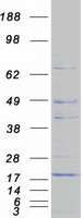 CISD1 Protein - Purified recombinant protein CISD1 was analyzed by SDS-PAGE gel and Coomassie Blue Staining