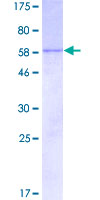 CISH / SOCS Protein - 12.5% SDS-PAGE of human CISH stained with Coomassie Blue