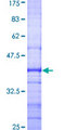 CISH / SOCS Protein - 12.5% SDS-PAGE Stained with Coomassie Blue.