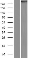 CIT / CRIK / Citron Protein - Western validation with an anti-DDK antibody * L: Control HEK293 lysate R: Over-expression lysate