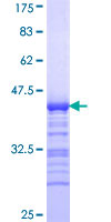 CIT / CRIK / Citron Protein - 12.5% SDS-PAGE Stained with Coomassie Blue.