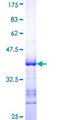 CITED1 Protein - 12.5% SDS-PAGE Stained with Coomassie Blue.