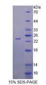 CITED1 Protein - Recombinant  Cbp/p300 Interacting Transactivator, With Glu/Asp Rich Carboxy Terminal Domain 1 By SDS-PAGE