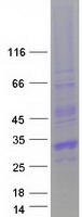 CITED1 Protein - Purified recombinant protein CITED1 was analyzed by SDS-PAGE gel and Coomassie Blue Staining
