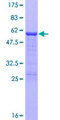 CITED2 Protein - 12.5% SDS-PAGE of human CITED2 stained with Coomassie Blue