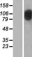 CIZ1 Protein - Western validation with an anti-DDK antibody * L: Control HEK293 lysate R: Over-expression lysate