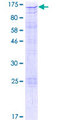 CIZ1 Protein - 12.5% SDS-PAGE of human CIZ1 stained with Coomassie Blue