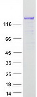 CIZ1 Protein - Purified recombinant protein CIZ1 was analyzed by SDS-PAGE gel and Coomassie Blue Staining