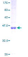 CKAP2 Protein - 12.5% SDS-PAGE of human CKAP2 stained with Coomassie Blue