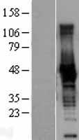 CKB / Creatine Kinase BB Protein - Western validation with an anti-DDK antibody * L: Control HEK293 lysate R: Over-expression lysate