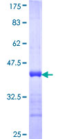 CKB / Creatine Kinase BB Protein - 12.5% SDS-PAGE Stained with Coomassie Blue.