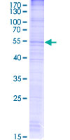 CKLF Protein - 12.5% SDS-PAGE Stained with Coomassie Blue
