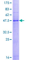 CKLFSF4 / CMTM4 Protein - 12.5% SDS-PAGE of human CMTM4 stained with Coomassie Blue