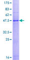 CKLFSF4 / CMTM4 Protein - 12.5% SDS-PAGE of human CMTM4 stained with Coomassie Blue