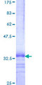 CKLFSF4 / CMTM4 Protein - 12.5% SDS-PAGE Stained with Coomassie Blue.