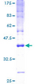 CKLFSF5 / CMTM5 Protein - 12.5% SDS-PAGE of human CKLFSF5 stained with Coomassie Blue