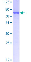 CKM / Creatine Kinase MM Protein - 12.5% SDS-PAGE of human CKM stained with Coomassie Blue