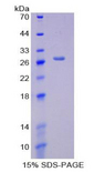 CKMT1A Protein - Recombinant Creatine Kinase, Mitochondrial 1A By SDS-PAGE