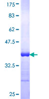 CKMT1B Protein - 12.5% SDS-PAGE Stained with Coomassie Blue.